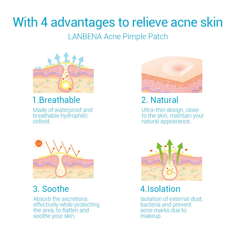 Acne Stickers, Fade, Acne Marks