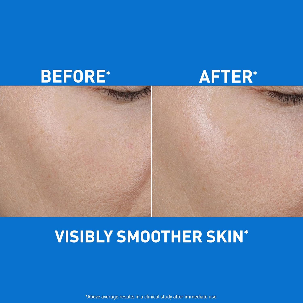 Hydrating Hyaluronic Acid Water Gel Moisturizer for Face, 1.7Oz