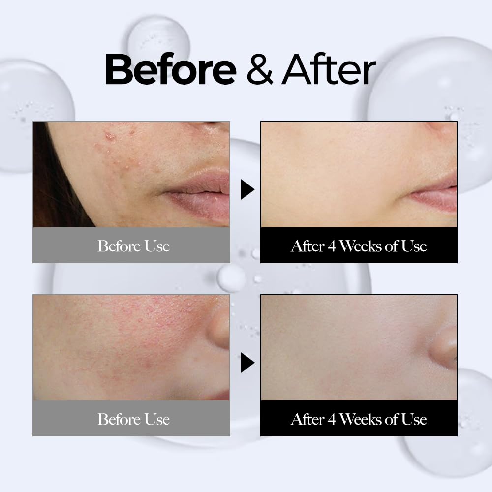 CELL29 Gen3 Hyclair Serum Ampoule 100ml