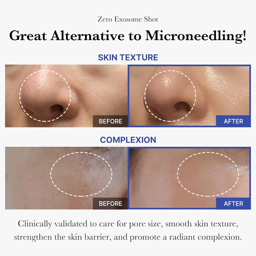 Medicube Exosome Shot Spicule Facial Serum