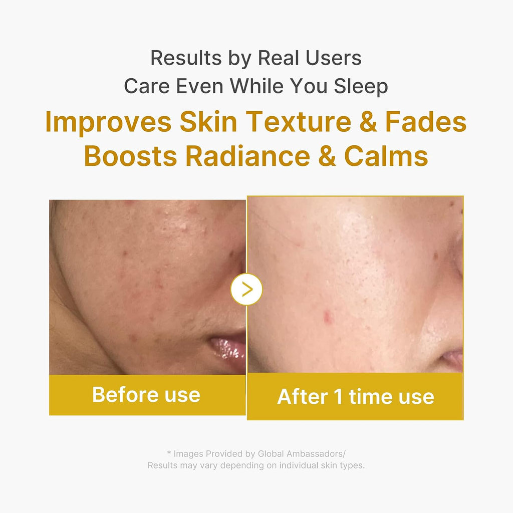 Medicube Wrapping Mask Overnight Peel Off Facial Mask 75ml