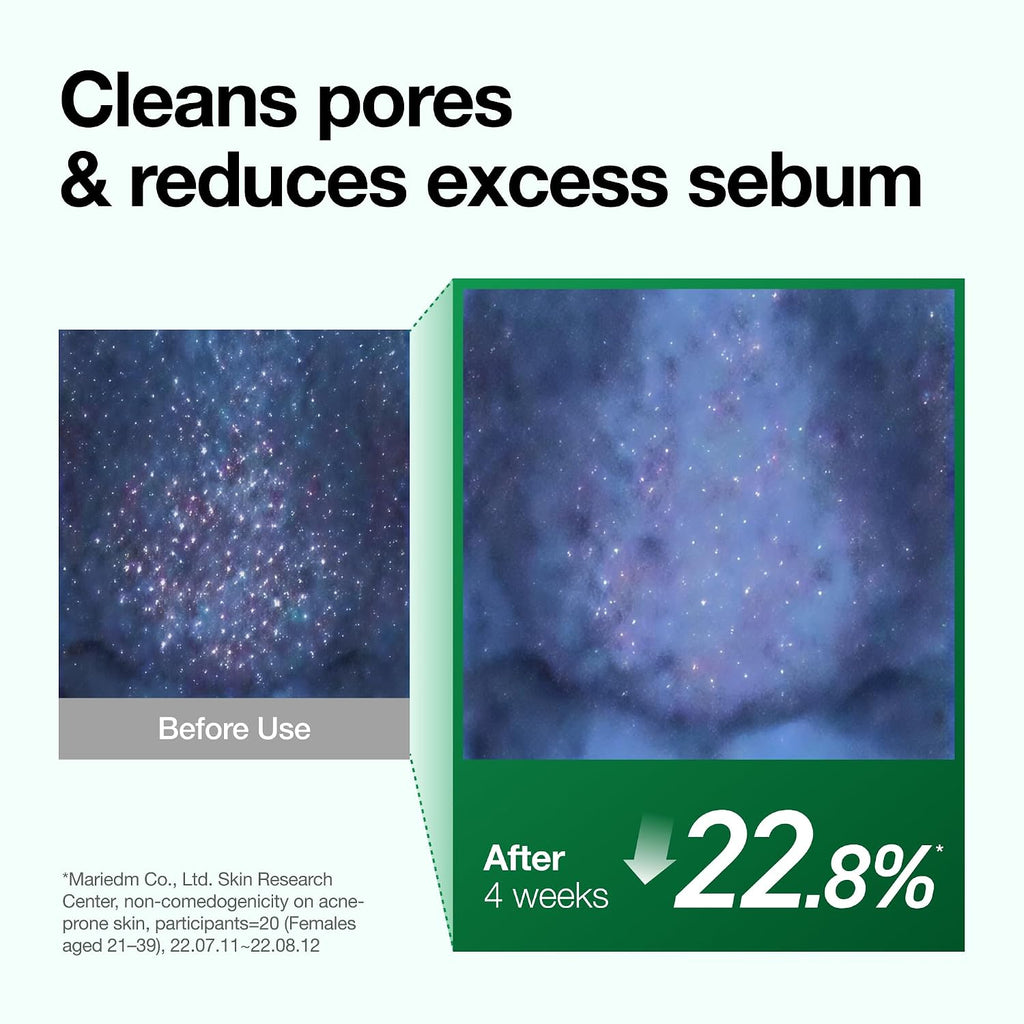 ANUA Double Cleansing Duo Set