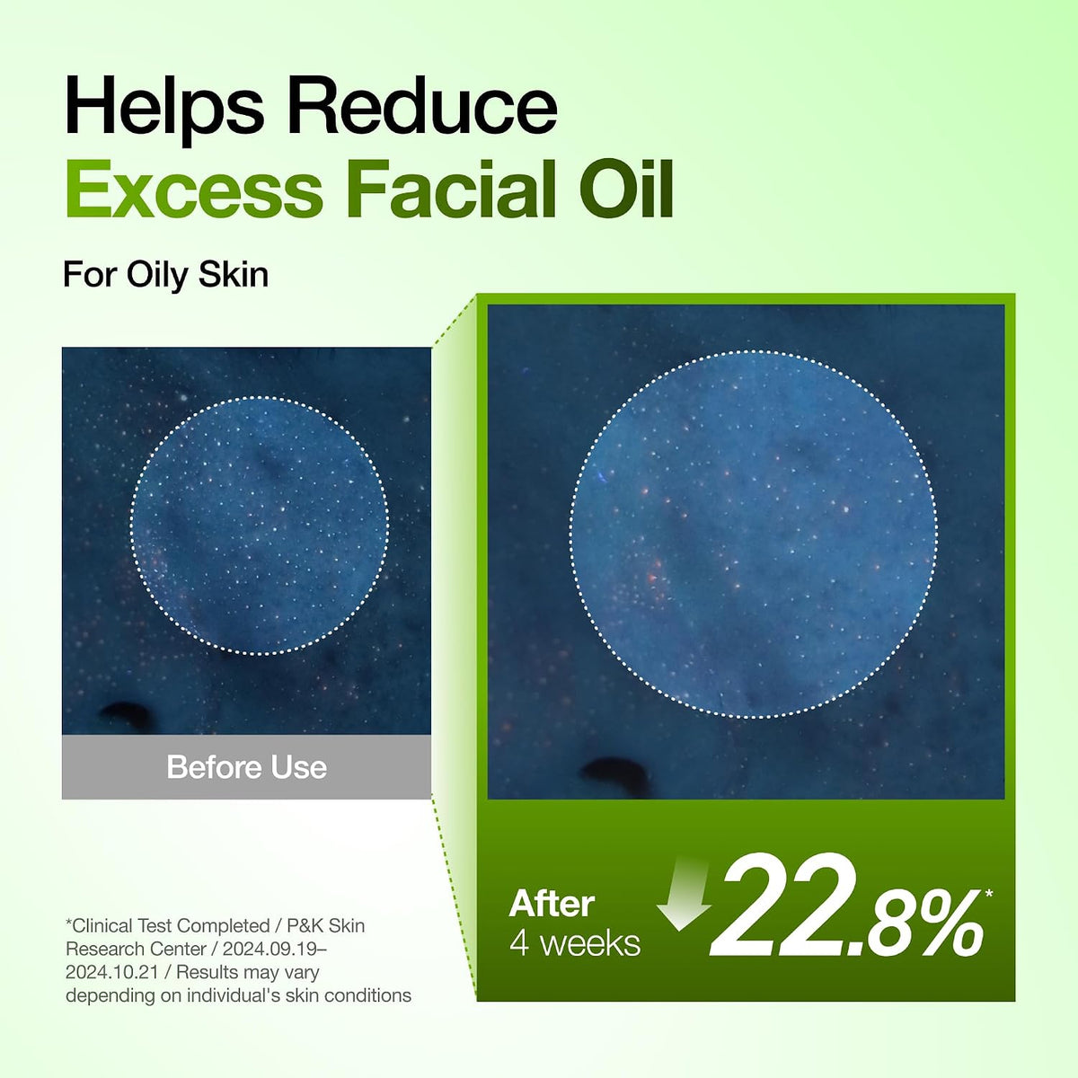 ANUA Azelaic Acid 10 Hyaluron Redness Soothing Serum 30ml