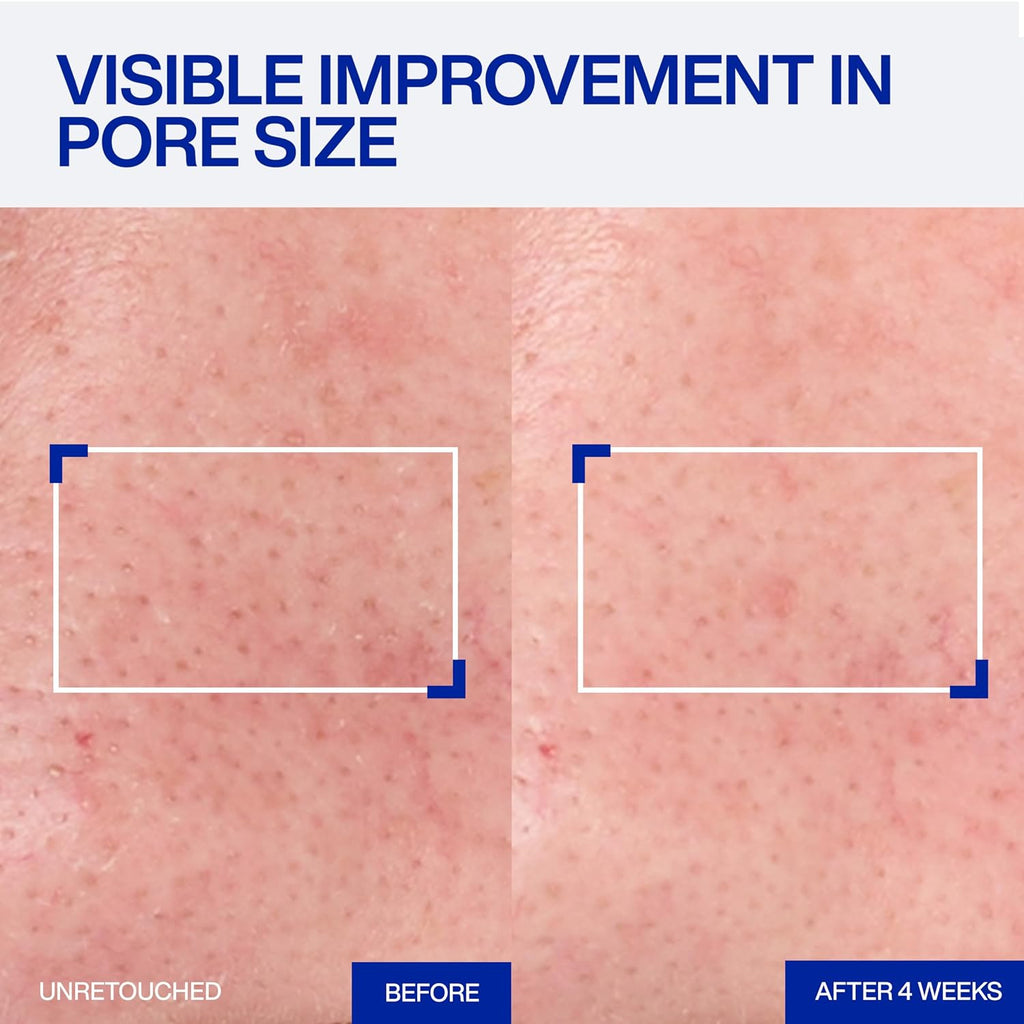 IOPE Expert Retinol RX 1% Super Bounce Serum