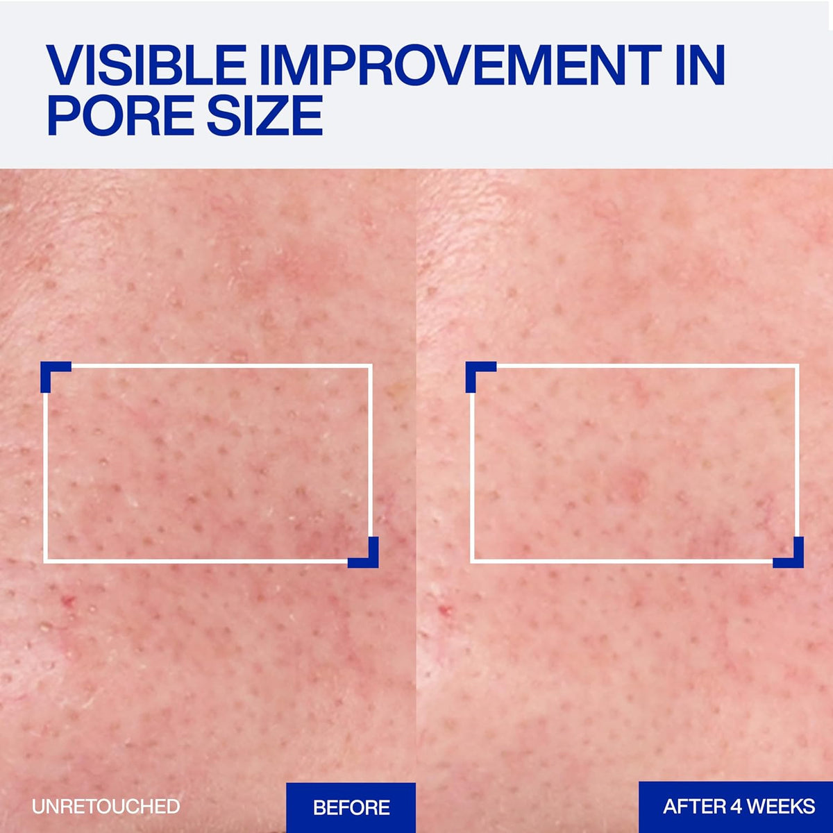 IOPE Expert Retinol RX 1% Super Bounce Serum