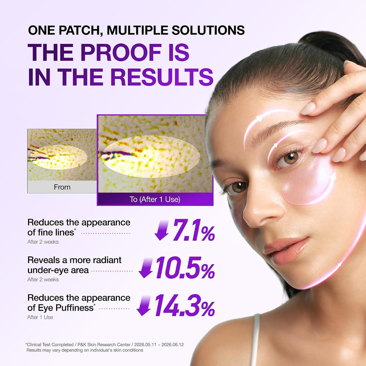 ANUA Retinol Berry Eye Patches 60 Count