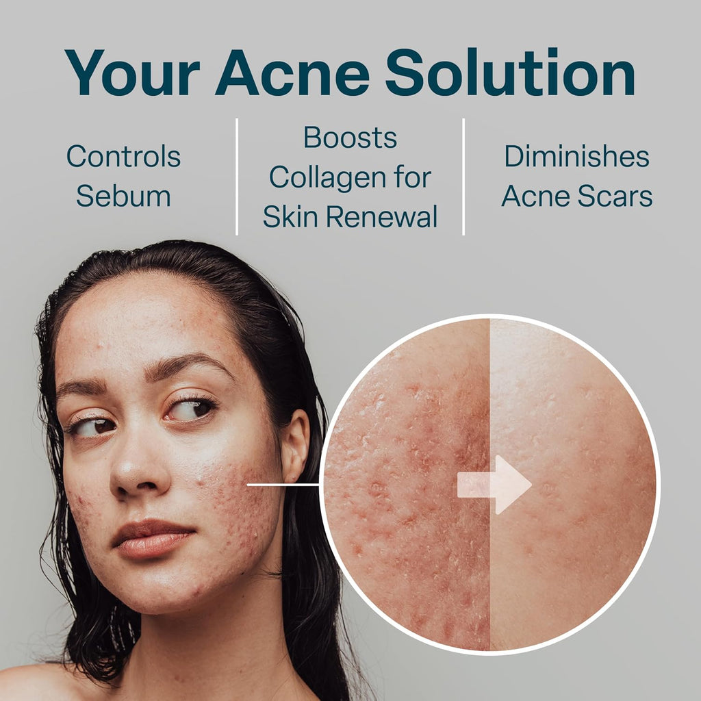QRxLabs Acne Clearing Pads 50ct