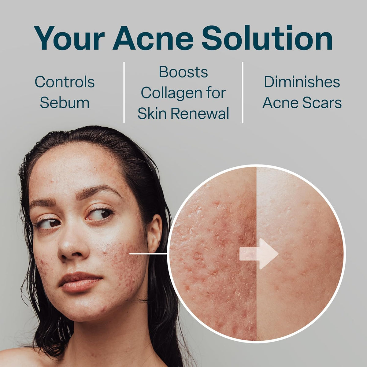QRxLabs Acne Clearing Pads 50ct