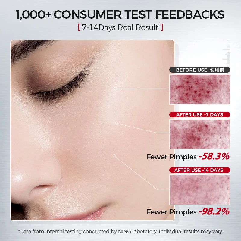 Amino Acid Facial Cleanser 100g – Salicylic Acid + Centella, Gentle Soothing Hydration & Oil Balance Care
