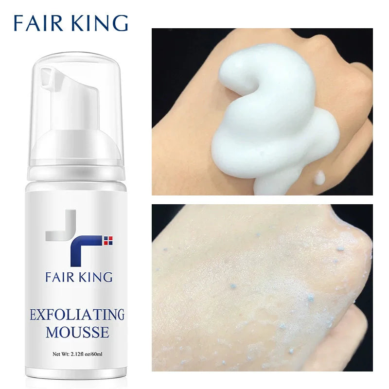 Exfoliating Rosemary Mousse – Gentle Deep Cleanser for Smooth Skin, Oil‑Control & Pore Refining