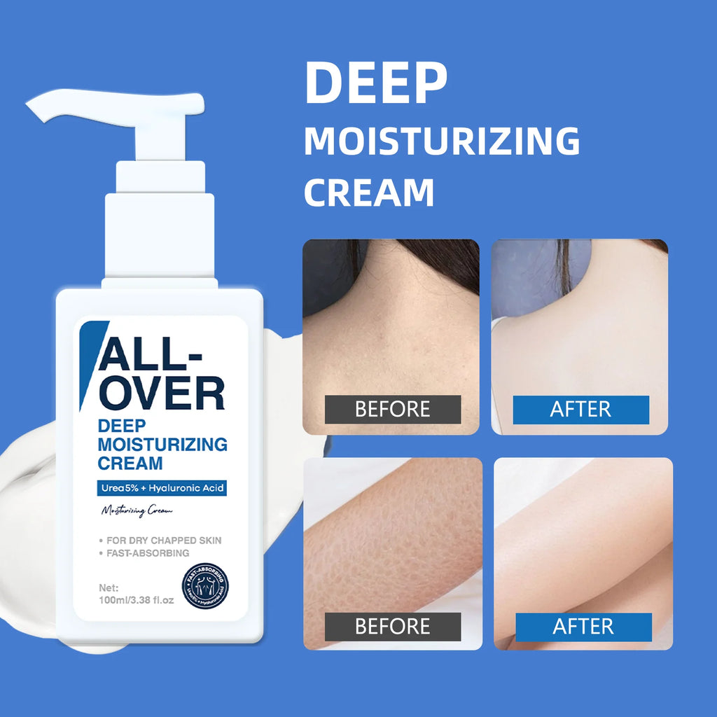 ALL-OVER Deep Moisturizing Cream 100ml 5% Urea Hyaluronic Acid Hydration Dry Chapped Skin Fast Absorption Face Body Hand Care