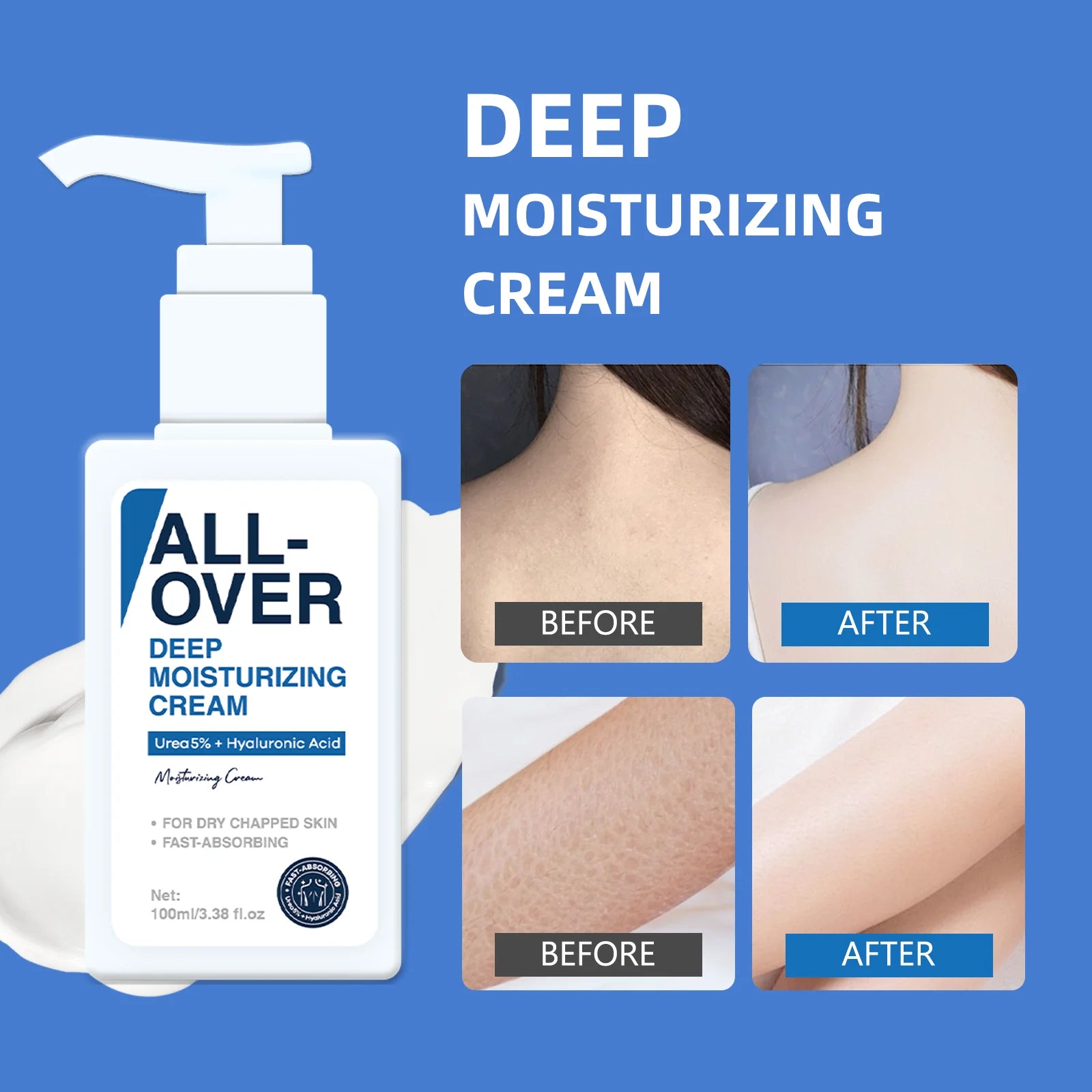 ALL-OVER Deep Moisturizing Cream 100ml 5% Urea Hyaluronic Acid Hydration Dry Chapped Skin Fast Absorption Face Body Hand Care