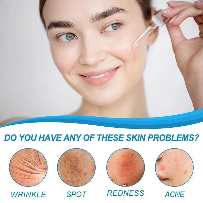 Remove W-rinkles Essence Anti A-ging Fade Fine Line Lifting Firming Repair Smooth Moisturizing Nourish Tighten Retinol B3 Serum