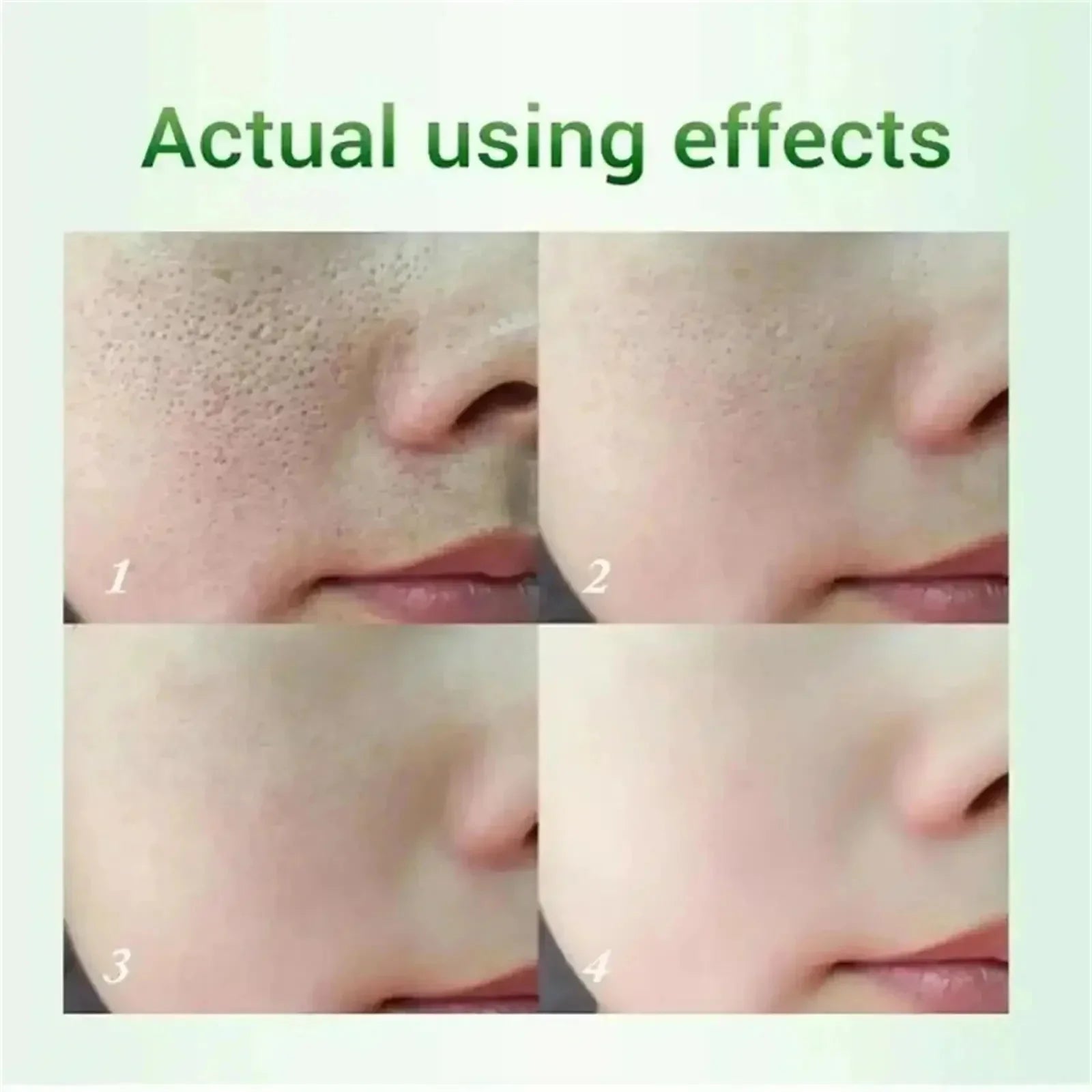 Pore Shrinking Cream Elimination Large Pores Blackehead Remove Acne Pit Repair Gel Tighten Face Smooth Skin Korean Care Products