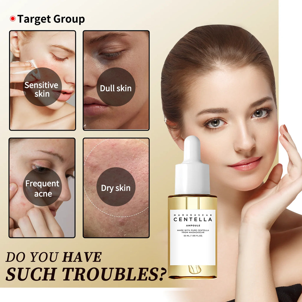 Centella Asiatica Serum 55ml - Sensitive skin soothing formula with acne fighting, deep moisturizing benefits for face