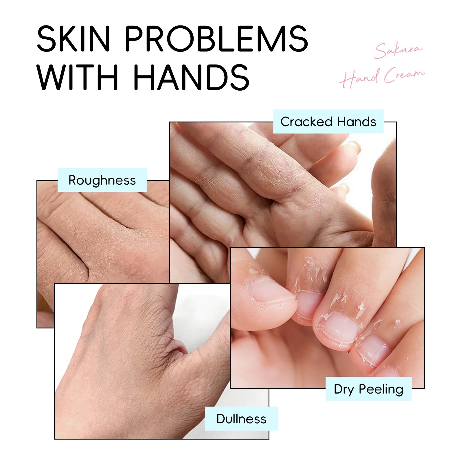 LAIKOU Sakura Hand Cream Whitening Wrinkle Removal Anti-crack Moisturizing Nourishing  Lotion Intensive Repair Hand Gream 30g