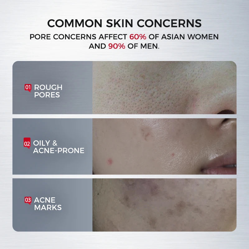 NING Ampoule Serum with 2% Salicylic Acid + Niacinamide – Skin Care for Oil Balance, Smooth-Looking Pores & Comfort