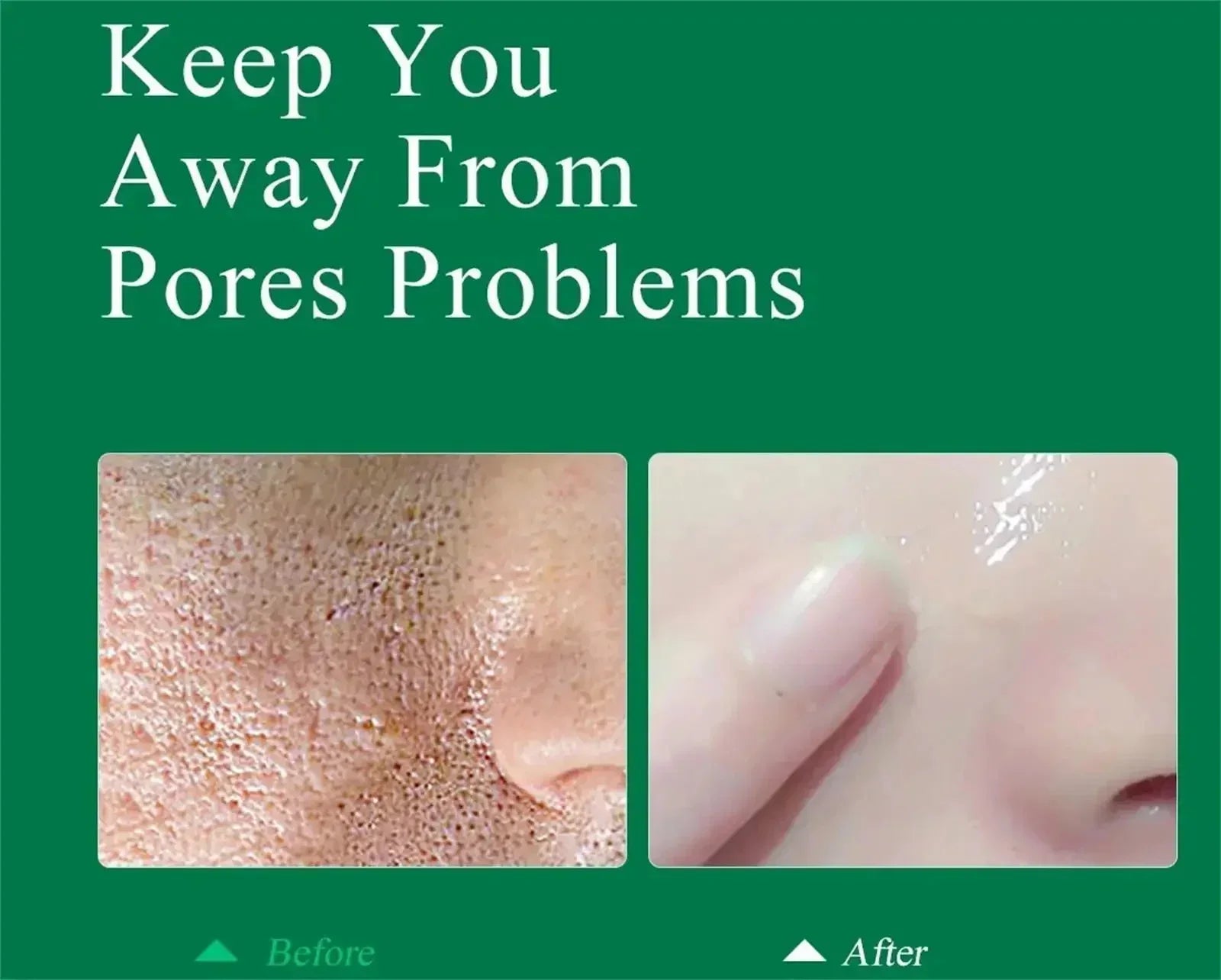 Pore Shrinking Cream Elimination Large Pores Blackehead Remove Acne Pit Repair Gel Tighten Face Smooth Skin Korean Care Products