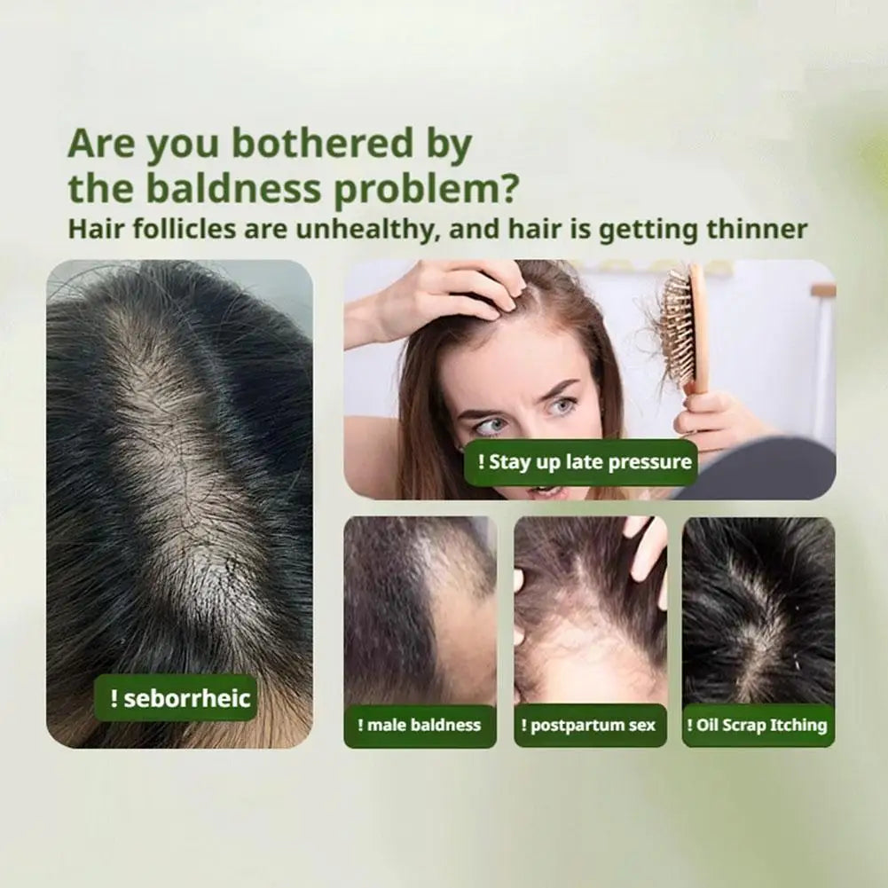 1/3PCS Grass & Platyclades Natural Herbal Shampoo Soap Strengthens Roots Controls Oil Cleanses Scalp Hair Growth Hair Soap