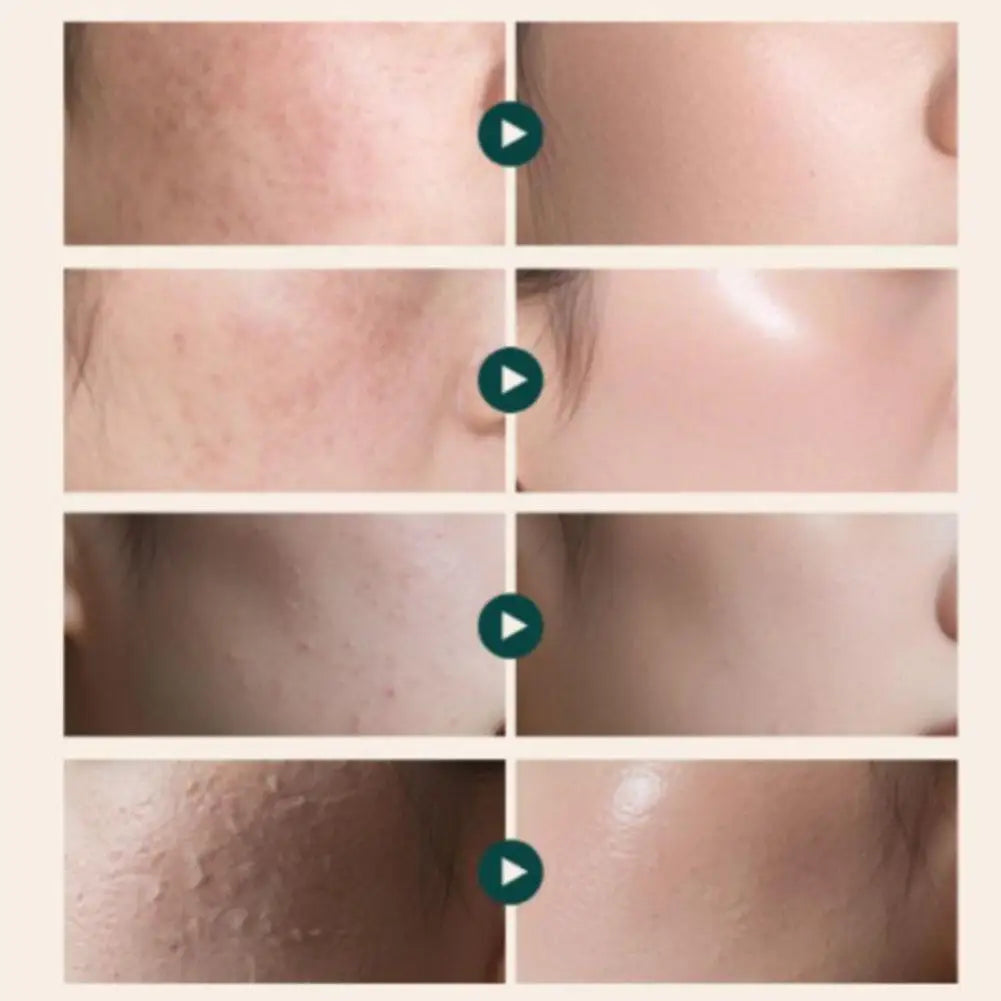 Facial Lifting & Firming Cream – Hydrating Rejuvenation Formula