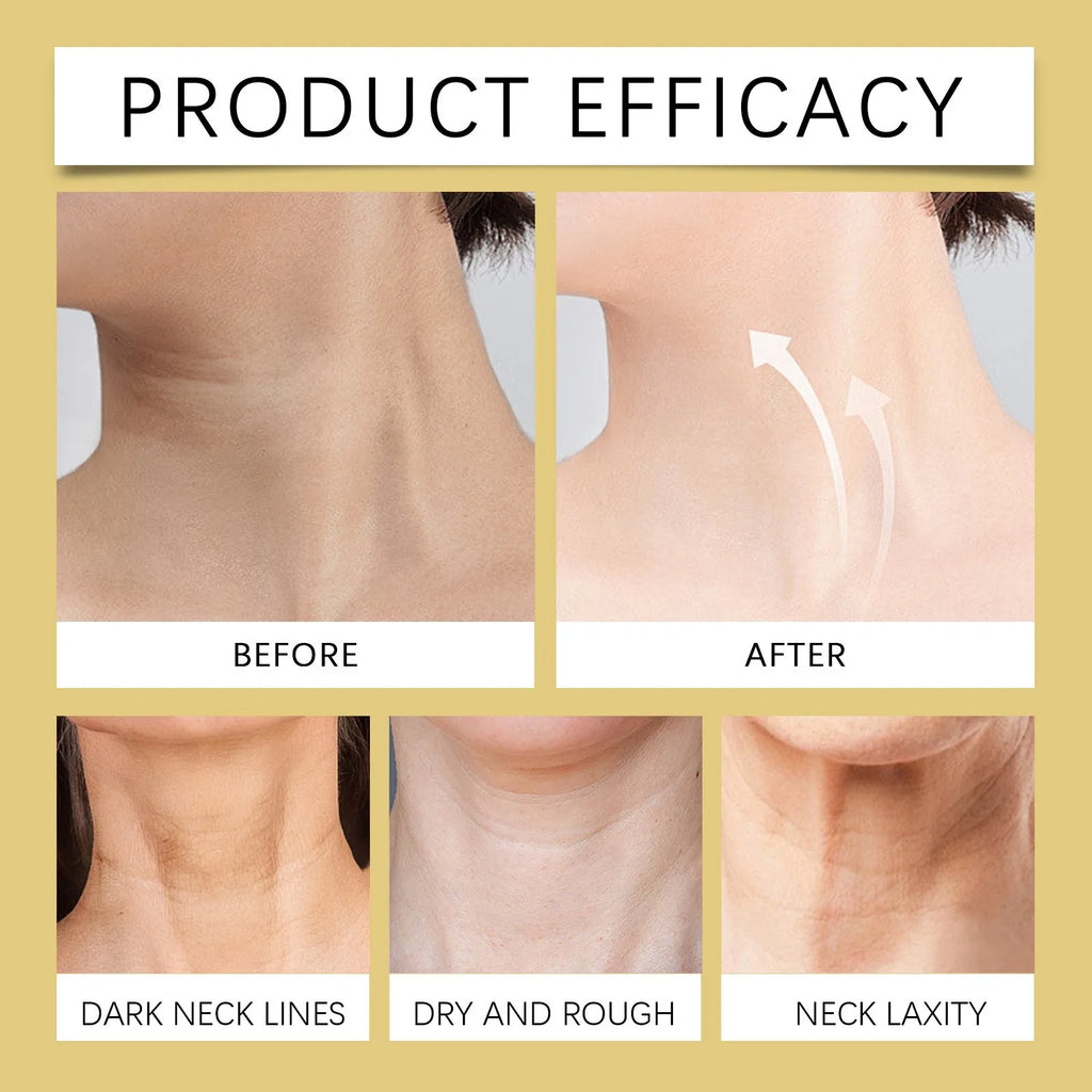Turkey Neck Corrector Firming Cream with Massage Roller – 120g