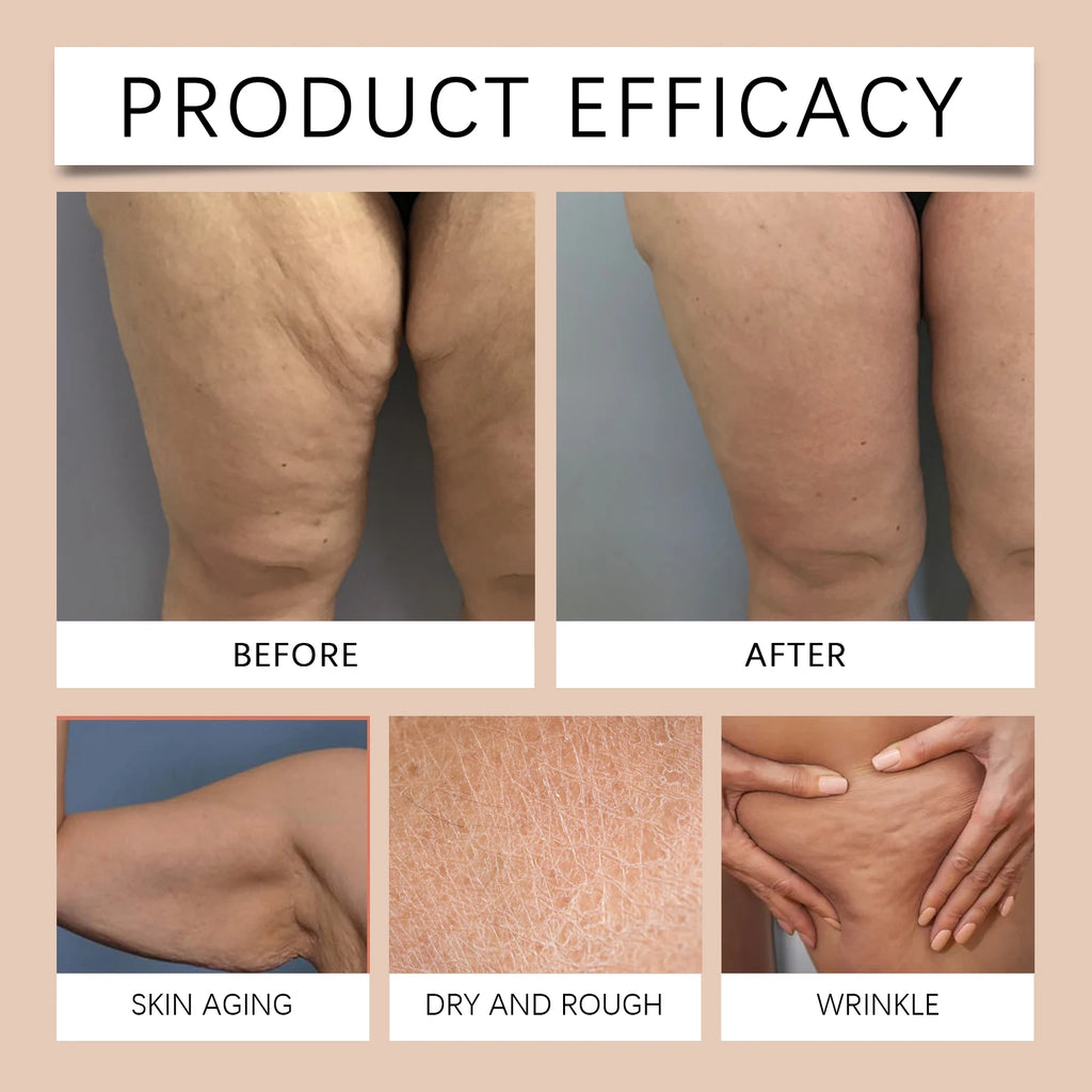 Moisturizing Anti Cellulite  Firming Body Oil Sagging Skin Tightening Anti-Aging for Body Refreshing Hydrate Firming Body Oil