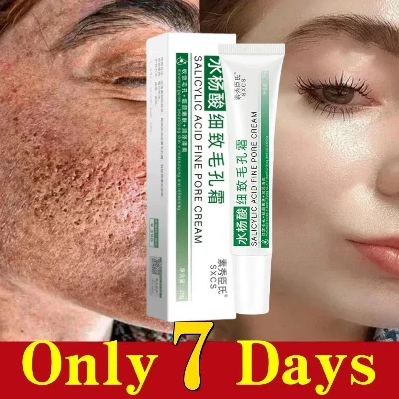 Pore Shrinking Cream Elimination Large Pores Blackehead Remove Acne Pit Repair Gel Tighten Face Smooth Skin Korean Care Products