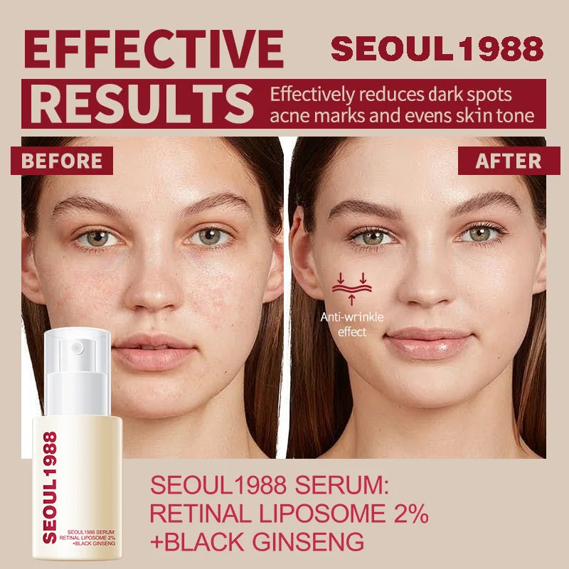 Seoul 1988 Korean Black Ginseng Retinol Serum with Niacinamide & Vitamin C - Hydrating Facial Ampoule for Daily Skin Care
