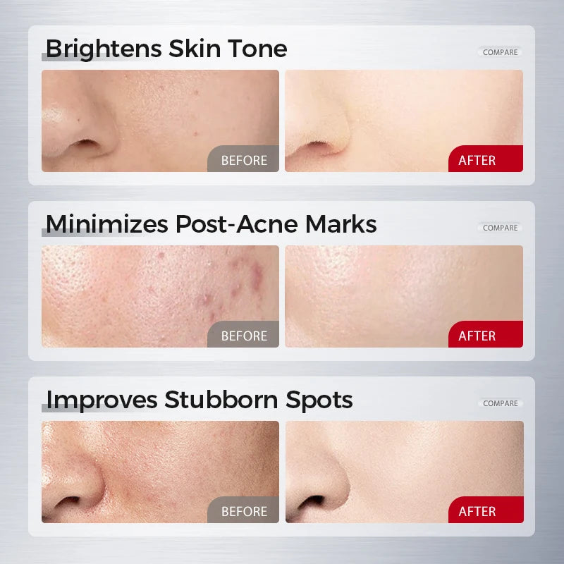 Face Ampoule Essence – Niacinamide, Salicylic Acid + Peptides for Even-Looking Tone, Smooth-Looking Lines & Blemish Comfort
