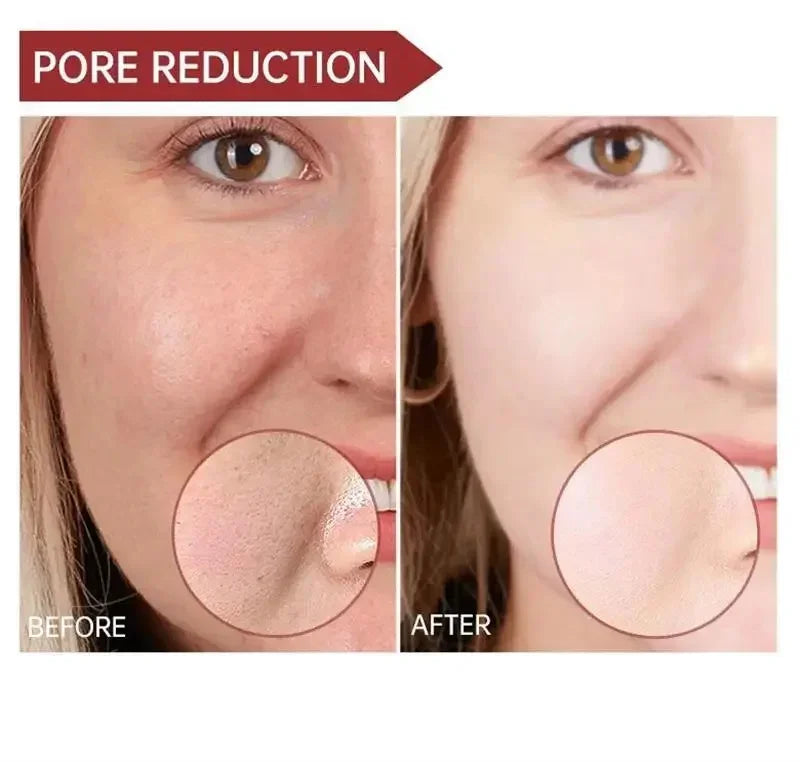 Pore Shrinking Cream Elimination Large Pores Blackehead Remove Acne Pit Repair Gel Tighten Face Smooth Skin Korean Care Products