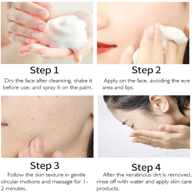 Exfoliating Rosemary Mousse – Gentle Deep Cleanser for Smooth Skin, Oil‑Control & Pore Refining