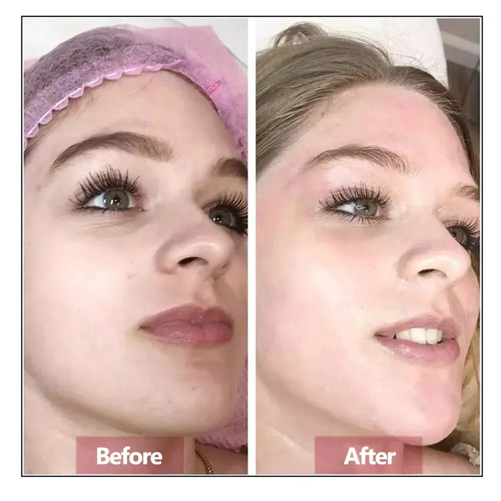 Hyaluronic Acid Face Serum – Deep Hydration, Firming & Anti‑Aging Skin Repair Essence