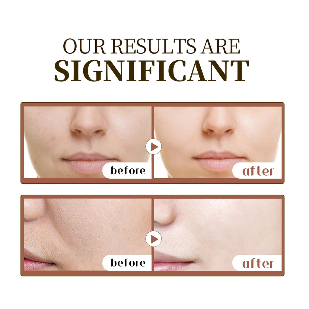 Centella Asiatica Serum 55ml - Sensitive skin soothing formula with acne fighting, deep moisturizing benefits for face