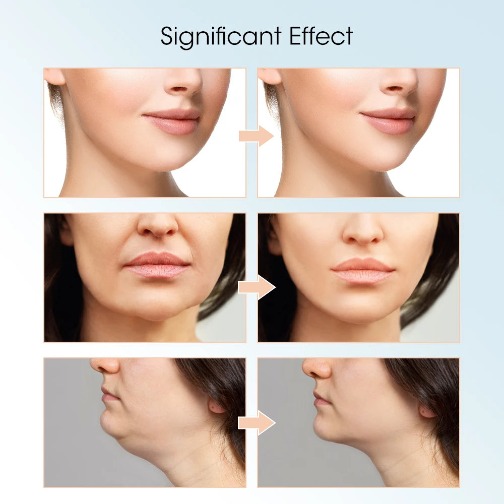 V-Face Tone – Appareil de massage LED portable