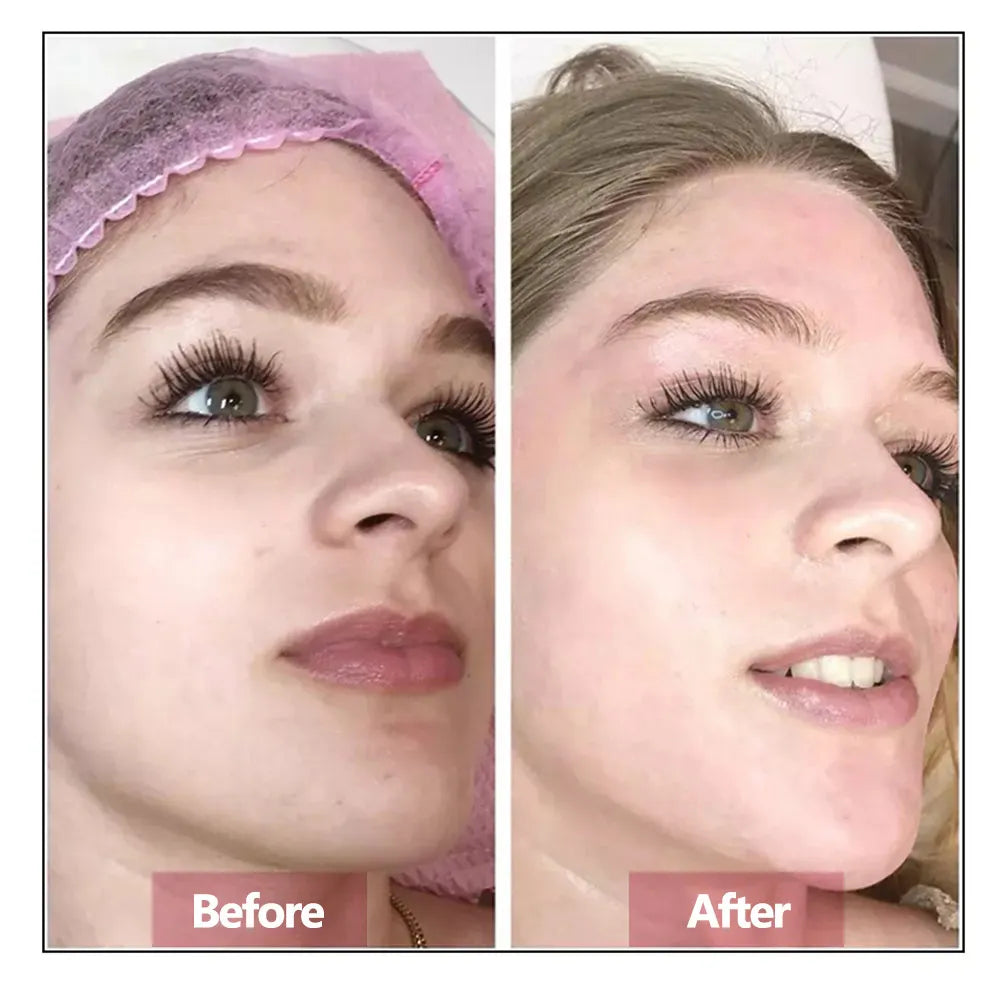 Hyaluronic Acid Face Serum – Deep Hydration, Firming & Anti‑Aging Skin Repair Essence
