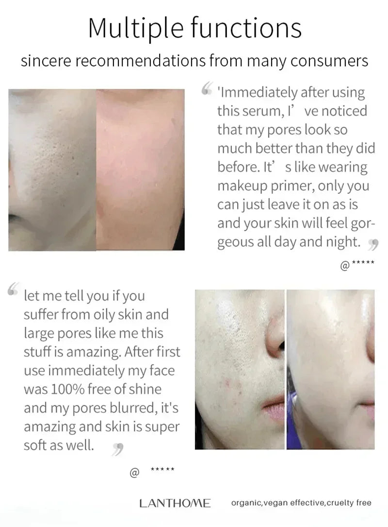 Pore Shrinking Cream Elimination Large Pores Blackehead Remove Acne Pit Repair Gel Tighten Face Smooth Skin Korean Care Products