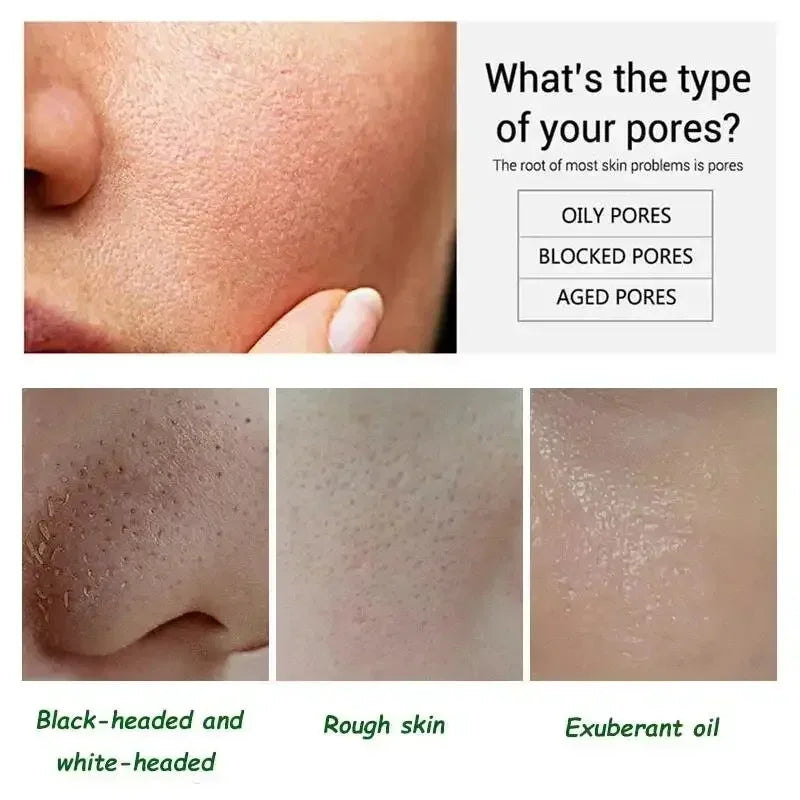 Pore Shrinking Cream Elimination Large Pores Blackehead Remove Acne Pit Repair Gel Tighten Face Smooth Skin Korean Care Products