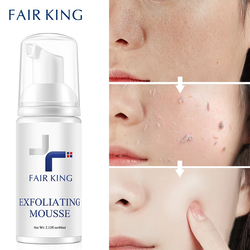Exfoliating Rosemary Mousse – Gentle Deep Cleanser for Smooth Skin, Oil‑Control & Pore Refining