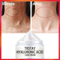 Anti-Wrinkles Cream Firming Lifting Face Neck Anti-Aging Remove Fine Lines Night Day Moisturizing Whitening Skin Care