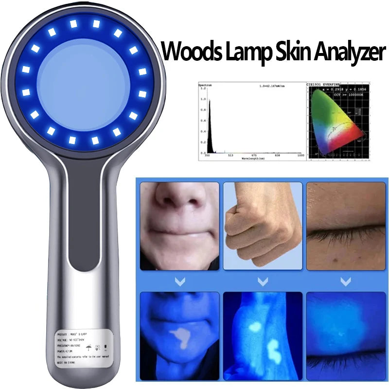 Facial Woods Lamp Skin Detection Device