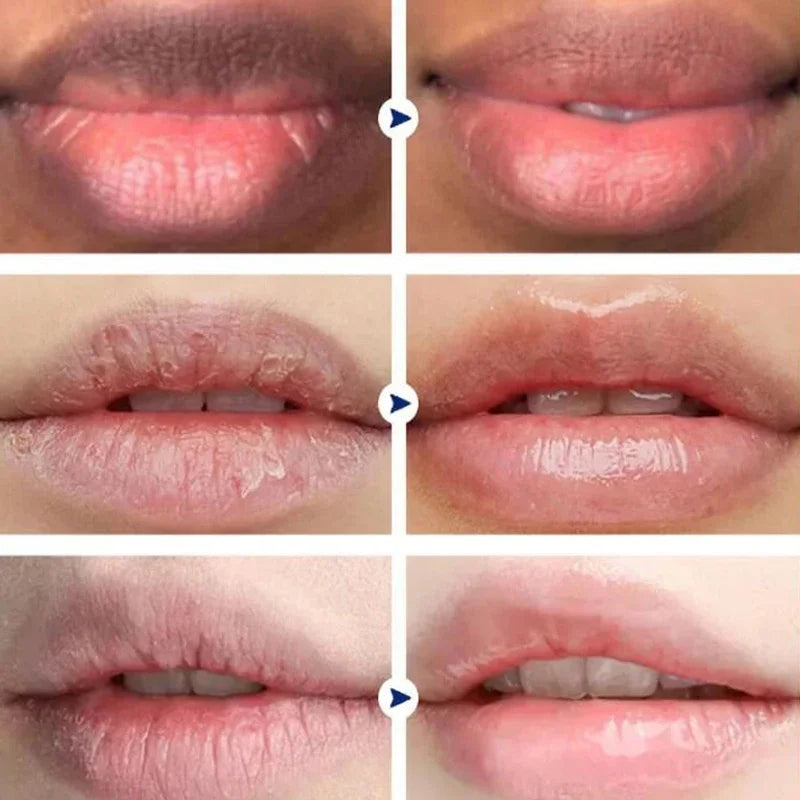 Lip Lightening Serum – Moisturizing Lip Oil for Soft, Smooth, Brighter‑Looking Lips