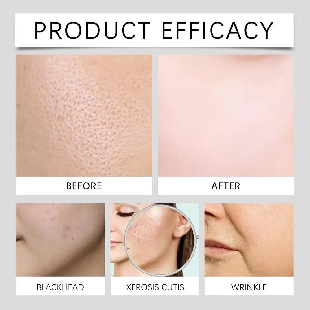 1/2Box Hyaluronic Acid Facial Set Gently hydrating and nourishing skin roller cleansing facial skin set Skin Care