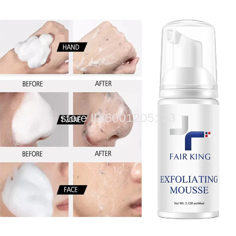 Exfoliating Rosemary Mousse – Gentle Deep Cleanser for Smooth Skin, Oil‑Control & Pore Refining