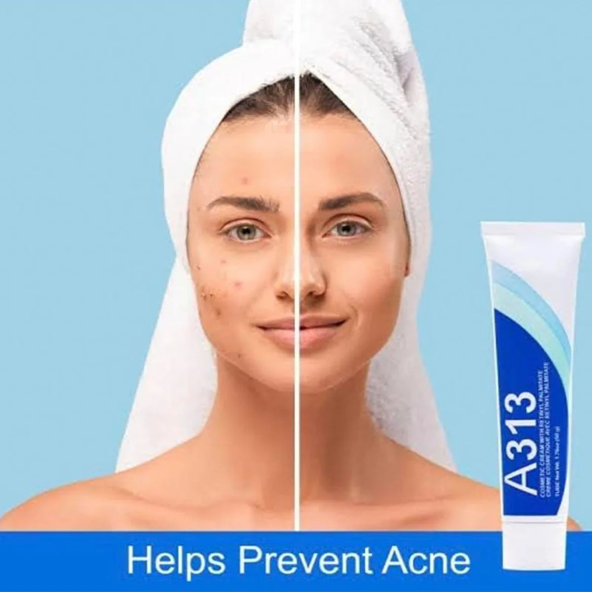 Retinol Vitamin A Cream A313 Tightens, Lifts, Softens and Hydrates The Skin  Facial Moisturizer