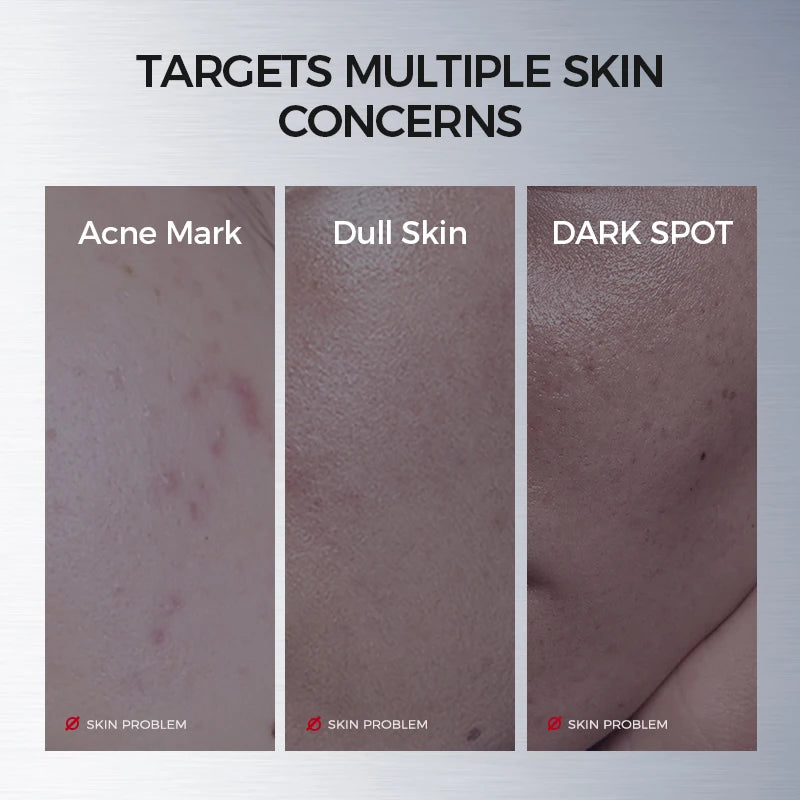 Face Ampoule Essence – Niacinamide, Salicylic Acid + Peptides for Even-Looking Tone, Smooth-Looking Lines & Blemish Comfort