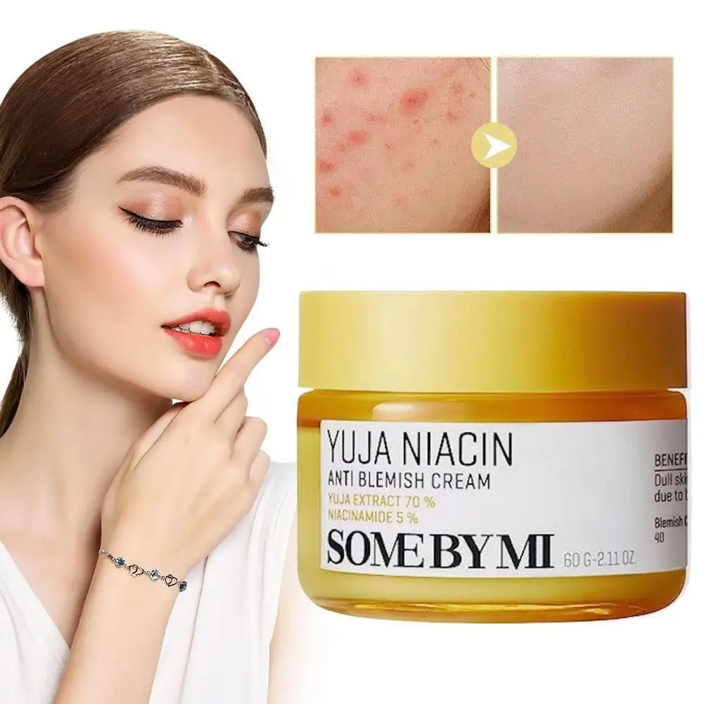 Korean SOME BY MI AHA BHA PHA 30 Days Miracle Cream Mild Exfoliating Deeply Moisturizer Improves Dull Skin Oil Control Skincare