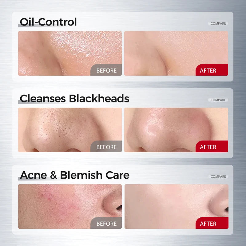 Amino Acid Facial Cleanser 100g – Salicylic Acid + Centella, Gentle Soothing Hydration & Oil Balance Care